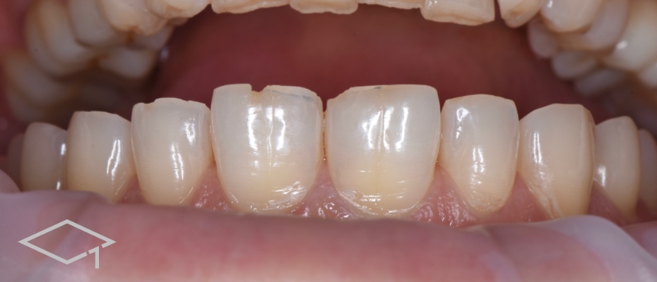 Before image