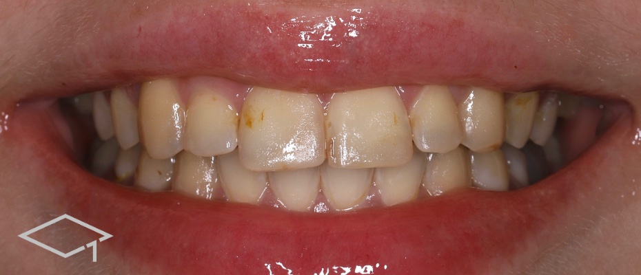 Before image